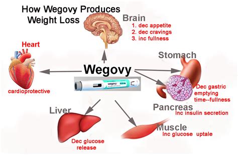 Weight-loss drug Wegovy reduces heart failure symptoms in obese patients